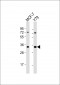 OR6C4 Antibody (C-term)